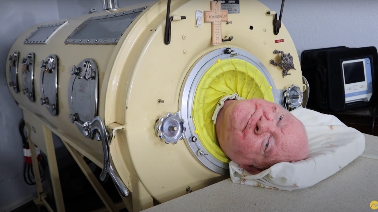 “Undying Spirit: A Tribute to Paul Alexander – The Longest Survivor in an Iron Lung”